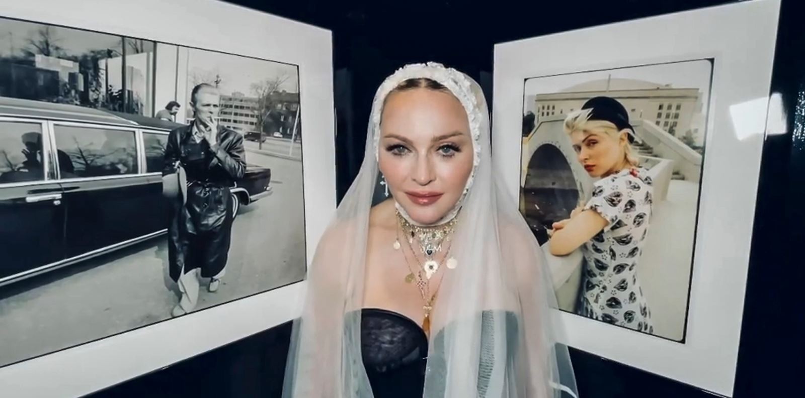 Мадона отговори на критиките за пластичните си операции