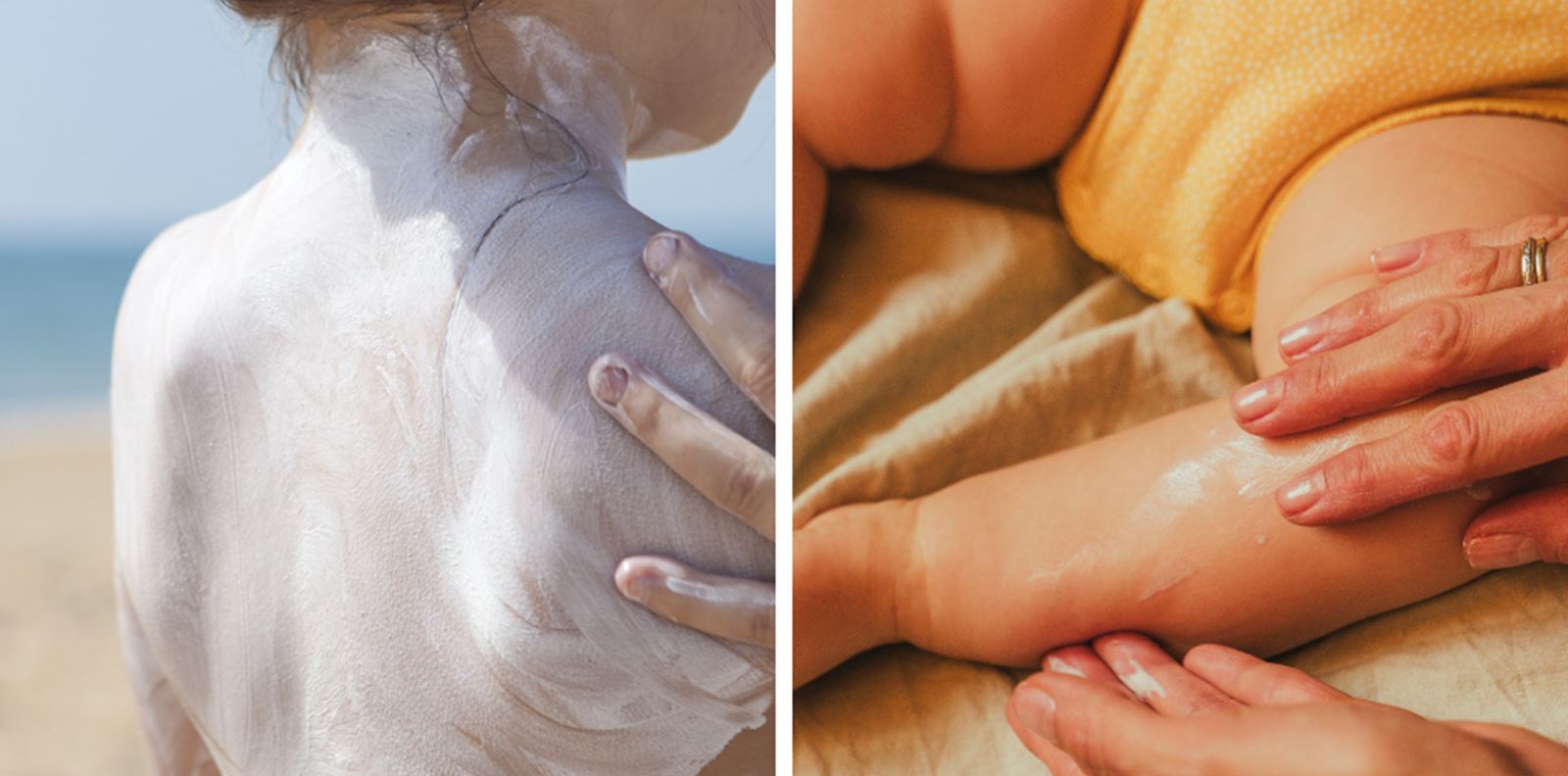 Иновация, слънцезащита, България