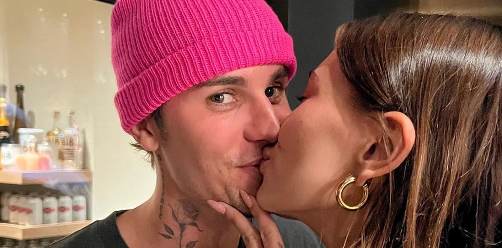 Джъстин Бийбър вече може да движи лицето си свободно