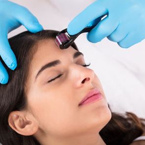 Какво представляват микроиглите и за какво са полезни