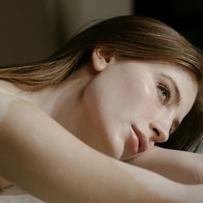 Ледена терапия за сияйна кожа