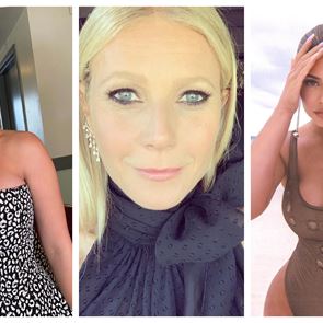 Кои звезди говорят свободно за филърите по лицето си