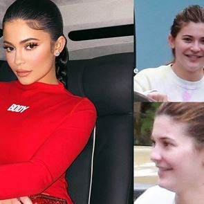 Несъвършена като нас? Истинското лице на &lt;em>Кайли&lt;/em> &lt;em>Дженър&lt;/em>...