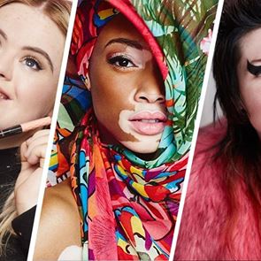 В кадър: модели с редки заболявания и особености във външността