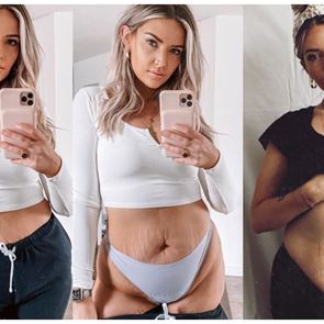 Ето кой да последвате - красавицата, която не крие своите стрии и отпуснат корем и всички я харесват заради това