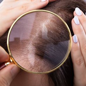 Не е лоша идея да проверите скалпа си за акне