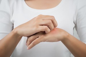 10 важни въпроса за кожните алергии и техните отговори