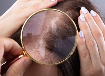 Не е лоша идея да проверите скалпа си за акне...