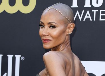 Джейда Пинкет Смит сподели битката си с алопецията