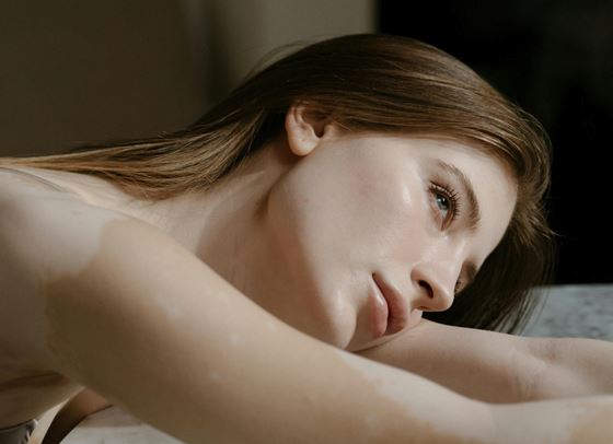 Ледена терапия за сияйна кожа