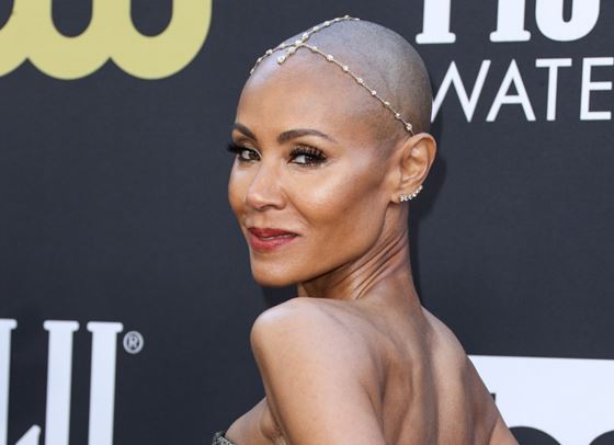 Джейда Пинкет Смит сподели битката си с алопецията